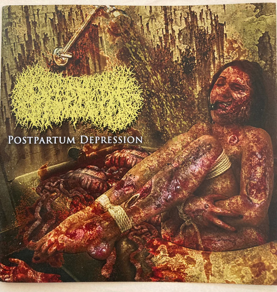 Postpartum Depression by Paediatrician