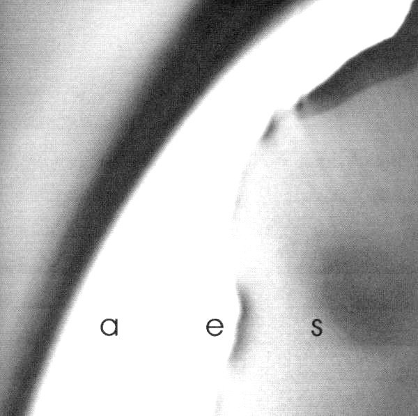 Aes by Skepticism